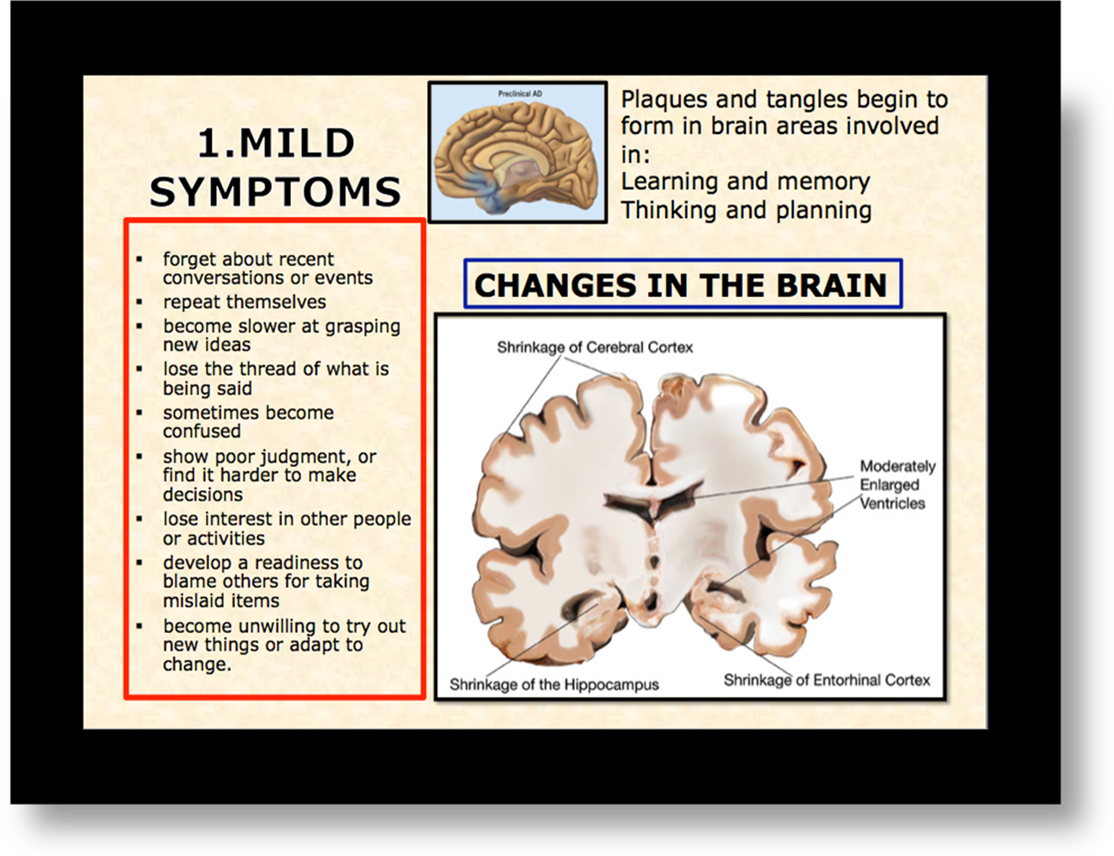 changes-in-brain